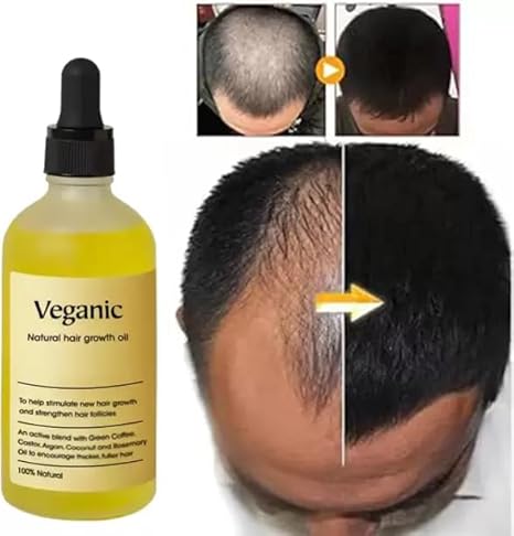 Vegan Natural Hair Oil (🔥Buy 1 Get 1 FREE Today Only)